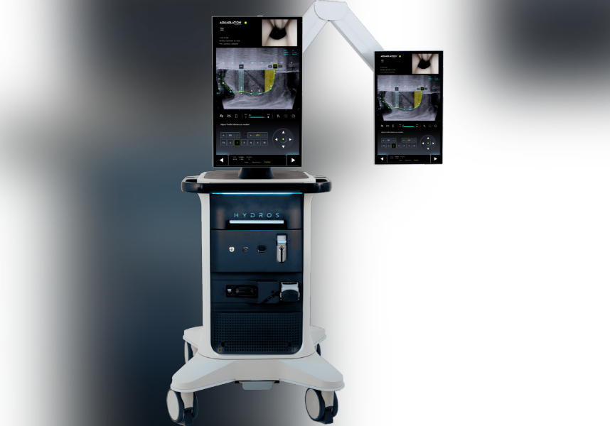 Springhill Medical Center Performs New BPh procedure